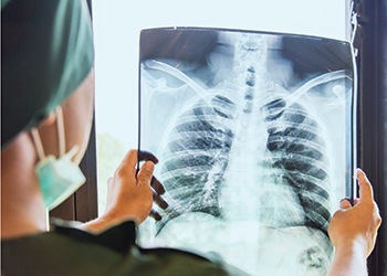 Provider reviewing a lung x-ray