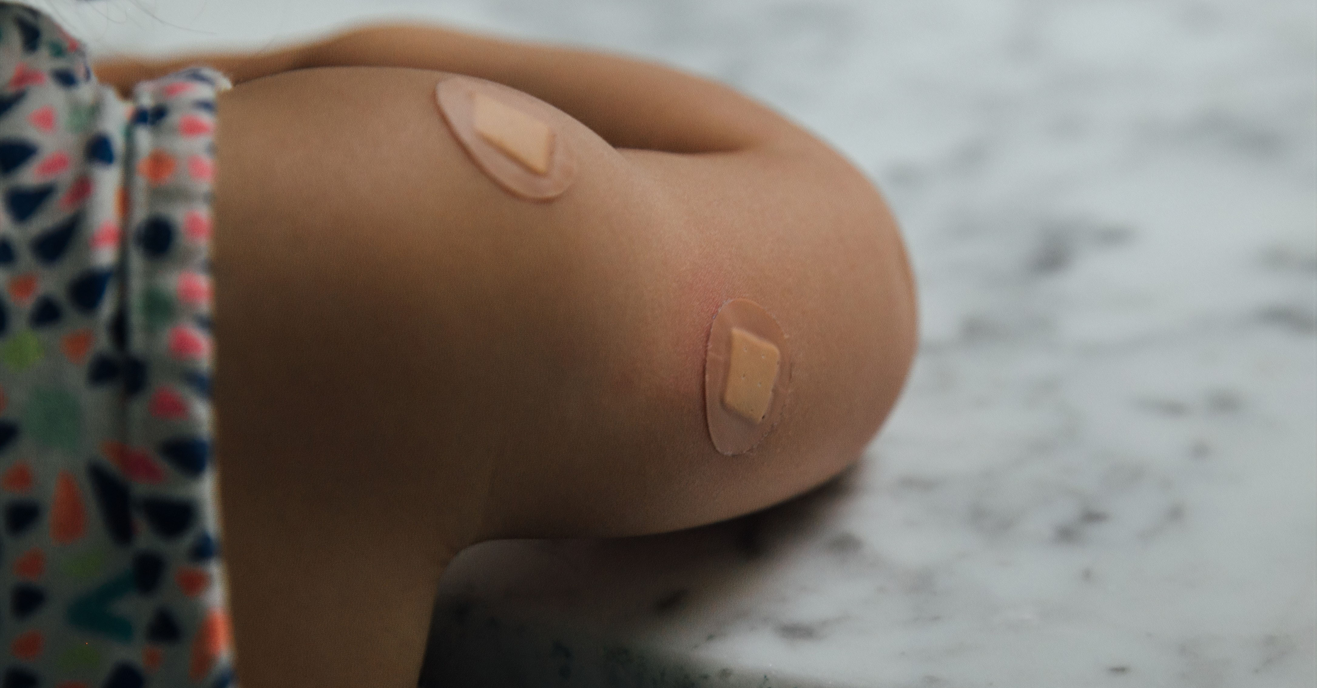 A child's arm with two bandaids on it.