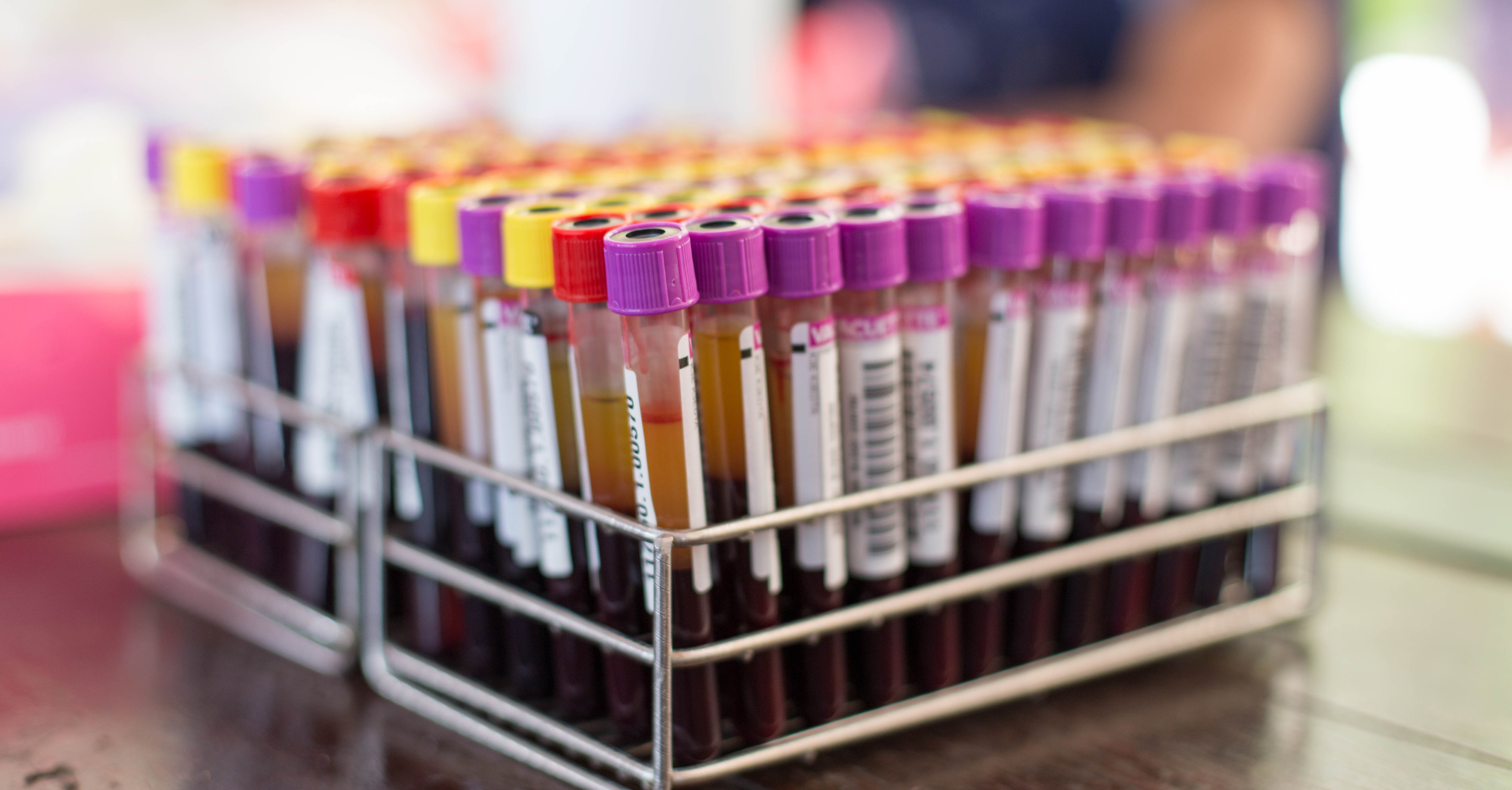 Test tubes of blood samples.