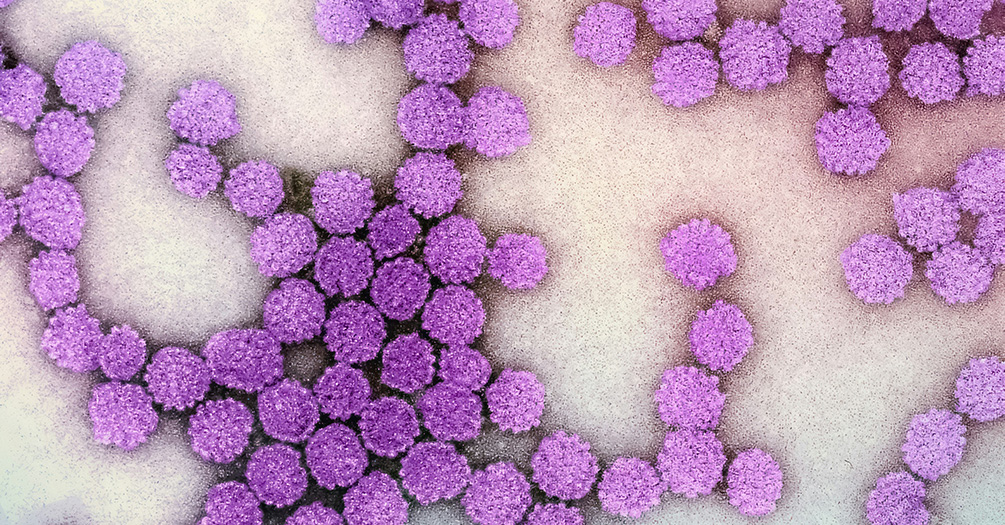 HPV self-sampling key for cancer screening in transgender patients