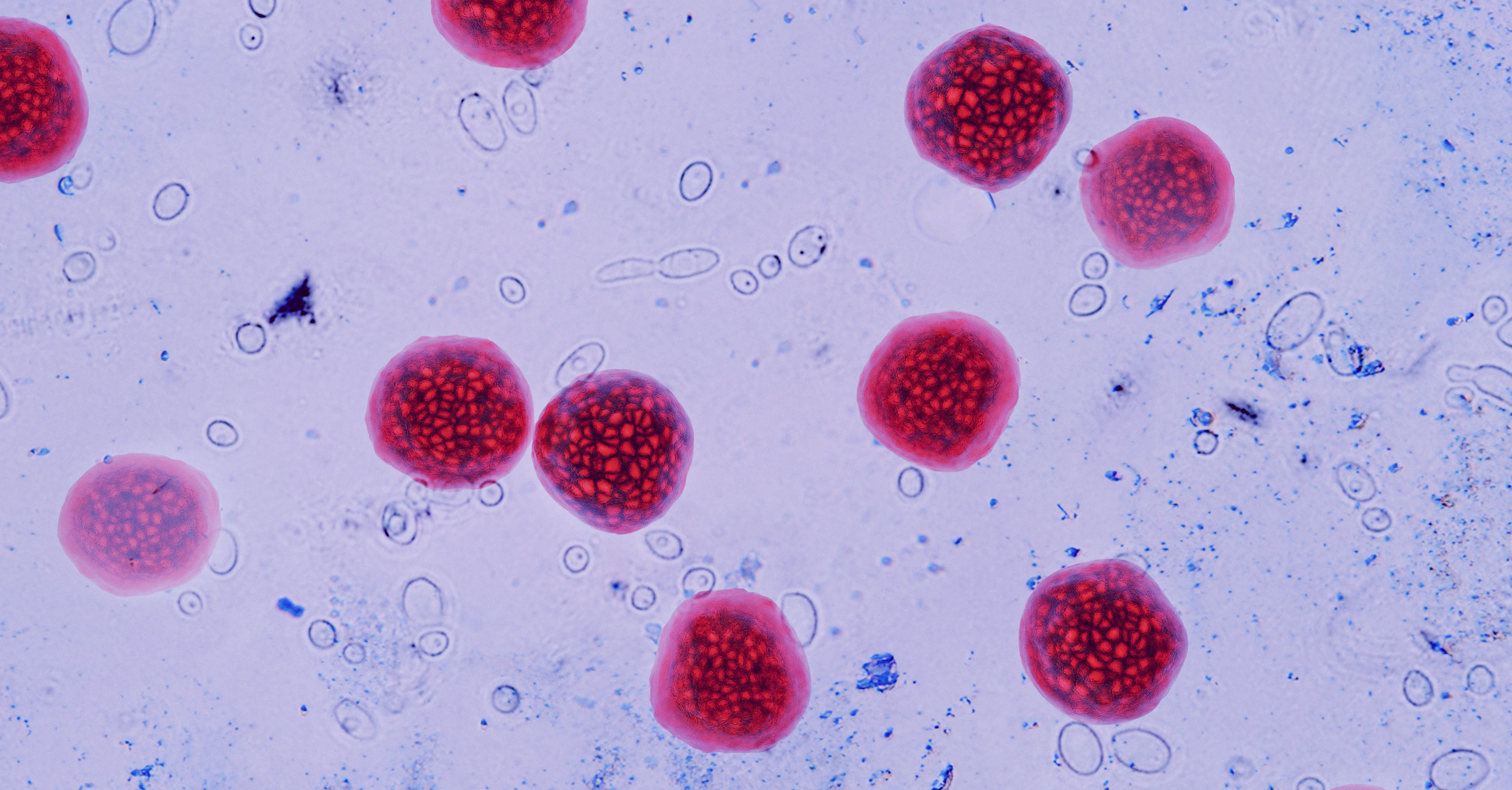 Cyclospora