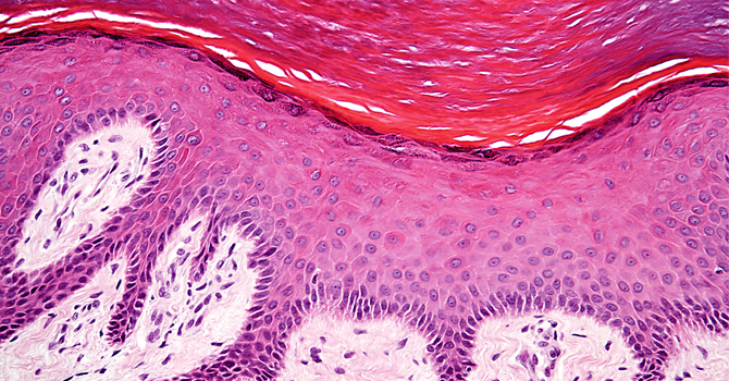 Micrograph of the epidermis and dermis of human finger skin. 