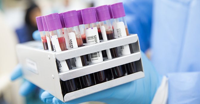 Checking Blood for Coronavirus Antibodies--3 Questions Answered About Serological Tests and Immunity