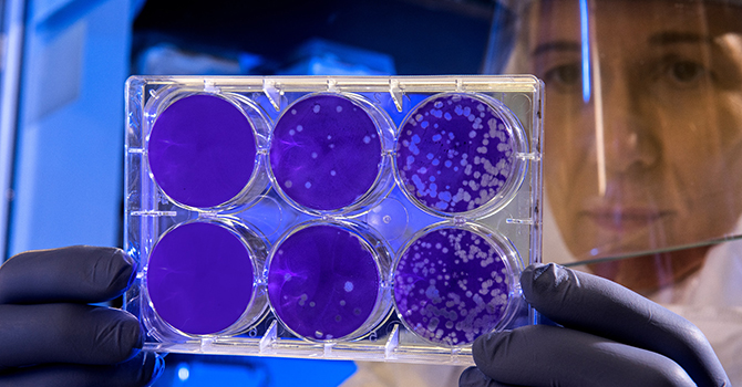 Scientist in a CDC lab examines the result of a plaque assay.